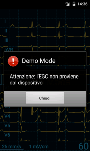 Demo ECG